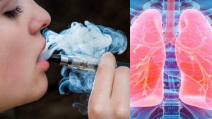 pennsylvania_woman_gets_wet_lung_-_vaping_wrongly_blamed-300x169