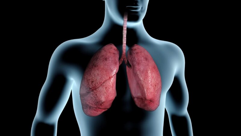 Smoking and Lungs Health